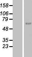 Calicin (CCIN) Human Over-expression Lysates NM_005893