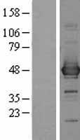 ls000883 ccbl1 kyat1 human over expression lysates nm 004059 wb testing 1