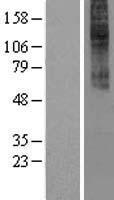 ls000886 cckar human over expression lysates nm 000730 wb testing 1