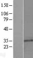Cyclin C (CCNC) Human Over-expression Lysates NM_005190