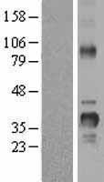 Cyclin D2 (CCND2) Human Over-expression Lysates NM_001759