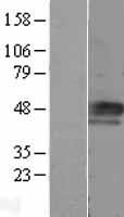 Cyclin E1 (CCNE1) Human Over-expression Lysates NM_001238