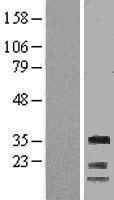 Cyclin G (CCNG1) Human Over-expression Lysates NM_199246
