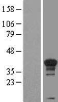 Cyclin H (CCNH) Human Over-expression Lysates NM_001239
