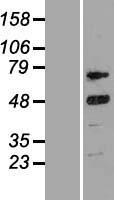 Cyclin T2 (CCNT2) Human Over-expression Lysates NM_001241