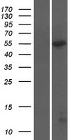 CCT6A Human Over-expression Lysates NM_001762
