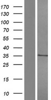 CD1 (CD1A) Human Over-expression Lysates NM_001763