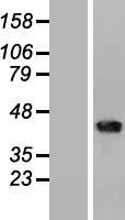 ls000910 cd1b human over expression lysates nm 001764 wb testing 1