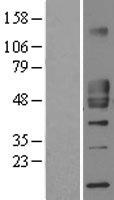 CD1 (CD1D) Human Over-expression Lysates NM_001766