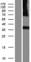 ls000913 cd1e human over expression lysates nm 001042585 wb testing 3