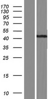 ls000913 cd1e human over expression lysates nm 001185114 wb testing 5