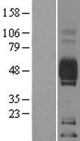CD2 Human Over-expression Lysates NM_001767