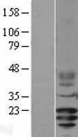 CD3G Human Over-expression Lysates NM_000073