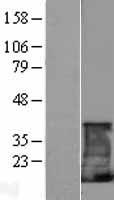 CD247 Human Over-expression Lysates NM_000734