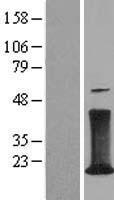 CD247 Human Over-expression Lysates NM_198053