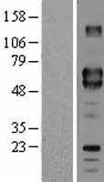 CD5 Human Over-expression Lysates NM_014207