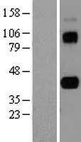 AIM (CD5L) Human Over-expression Lysates NM_005894