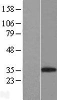 CD8A Human Over-expression Lysates NM_001768