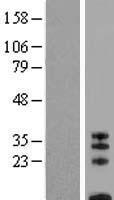 CD8B Human Over-expression Lysates NM_172213
