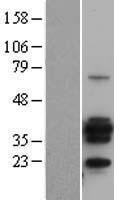 CD20 (MS4A1) Human Over-expression Lysates NM_021950
