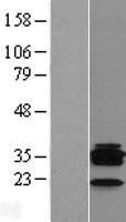 CD20 (MS4A1) Human Over-expression Lysates NM_152866