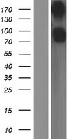 ls000933 cd22 human over expression lysates nm 001185101 wb testing 1
