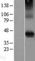 CD28 Human Over-expression Lysates NM_006139