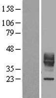 CD153 (TNFSF8) Human Over-expression Lysates NM_001244