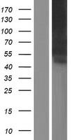 SIGLEC6 Human Over-expression Lysates NM_001177548