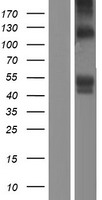 SIGLEC6 Human Over-expression Lysates NM_001177549