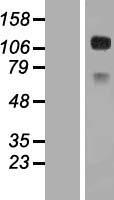 CD34 Human Over-expression Lysates NM_001025109