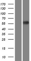 SCARB1 Human Over-expression Lysates NM_001082959