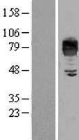 LIMPII (SCARB2) Human Over-expression Lysates NM_005506
