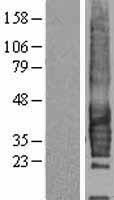CD37 Human Over-expression Lysates NM_001774