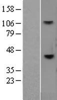 CD38 Human Over-expression Lysates NM_001775
