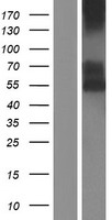 ls000953 cd39 entpd1 human over expression lysates nm 001164179 wb testing 1