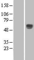ENTPD2 Human Over-expression Lysates NM_203468