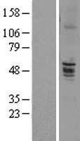 ENTPD6 Human Over-expression Lysates NM_001247
