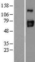 ls000956 entpd3 human over expression lysates nm 001248 wb testing 1