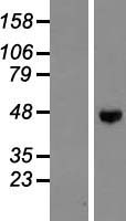 ENTPD5 Human Over-expression Lysates NM_001249