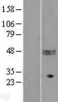 CD47 Human Over-expression Lysates NM_001777