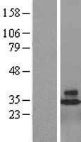 CD48 Human Over-expression Lysates NM_001778