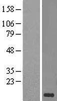 ls000966 cd59 human over expression lysates nm 203330 wb testing 2