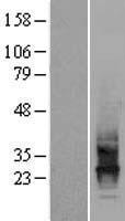CD63 Human Over-expression Lysates NM_001780