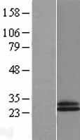 CD69 Human Over-expression Lysates NM_001781