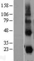 CD70 Human Over-expression Lysates NM_001252