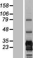 ls000974 cd79b human over expression lysates nm 000626 wb testing 1