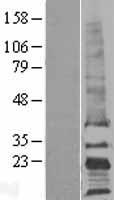 TAPA1 (CD81) Human Over-expression Lysates NM_004356