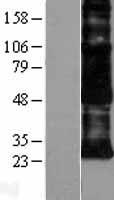 ls000976 cd97 adgre5 human over expression lysates nm 001784 wb testing 1