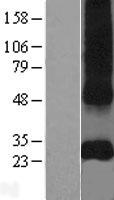 CD151 Human Over-expression Lysates NM_004357
